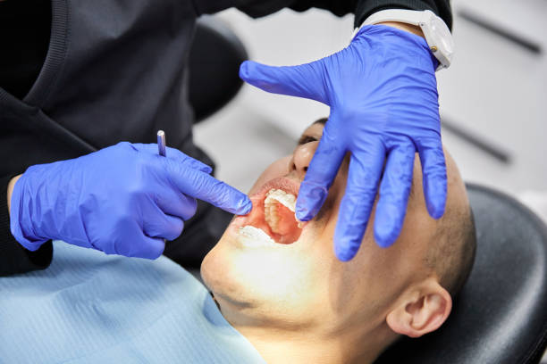 Best Knocked-Out Tooth Emergency  in Lynchburg, MS